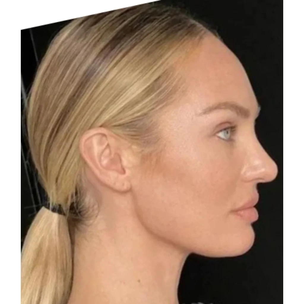Candice Swanepoel side