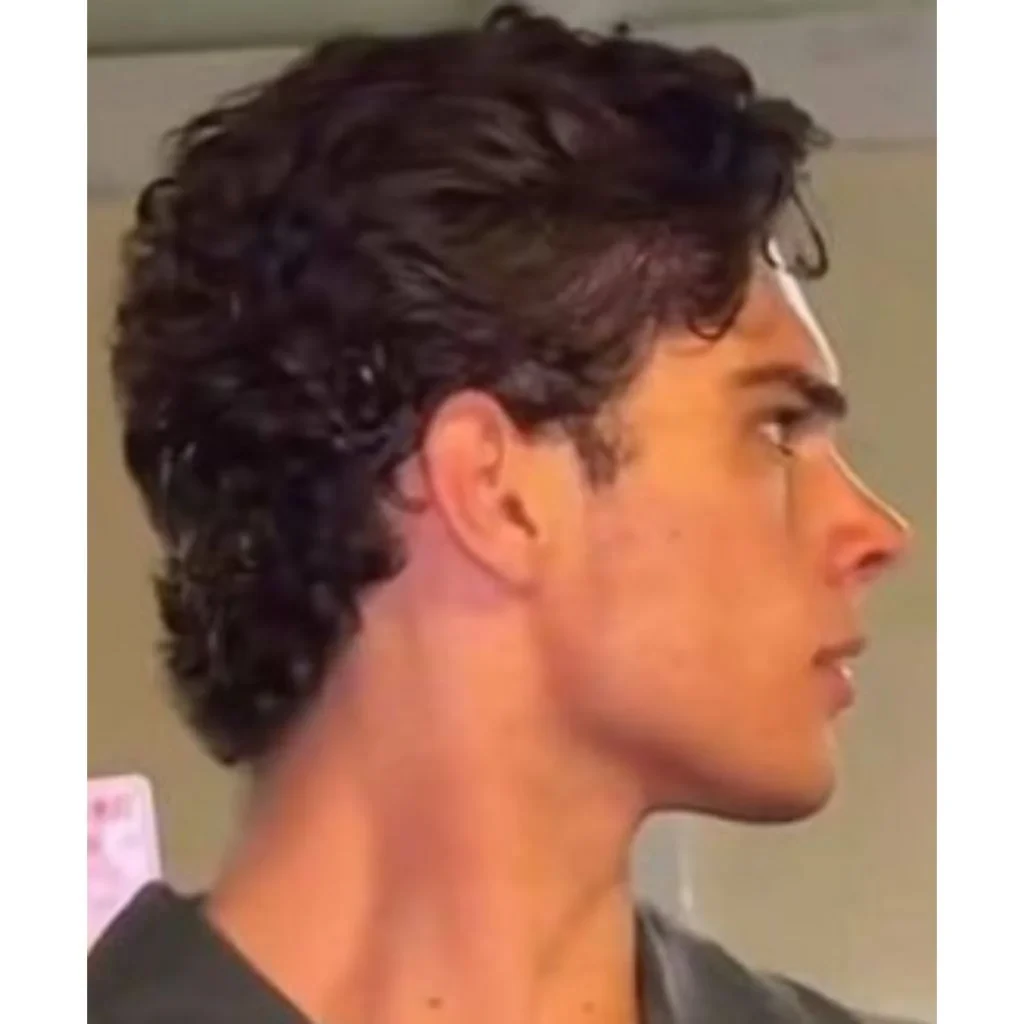 Clavicular side
