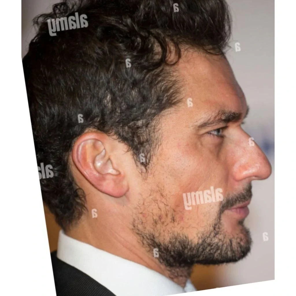 David Gandy side