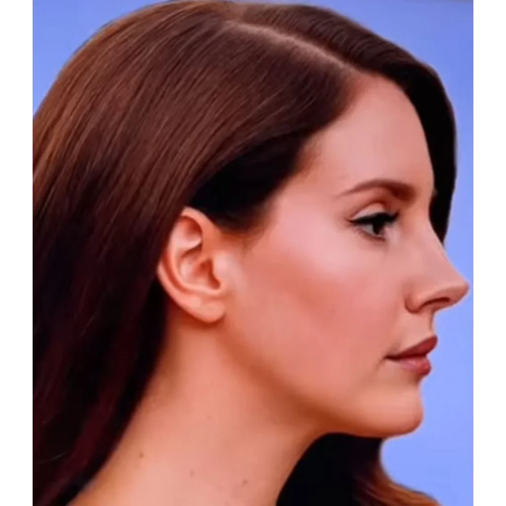 Lana Del Rey side