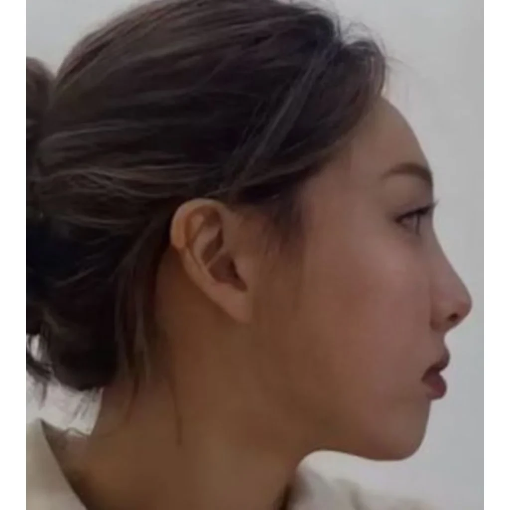 Nayeon (TWICE) side