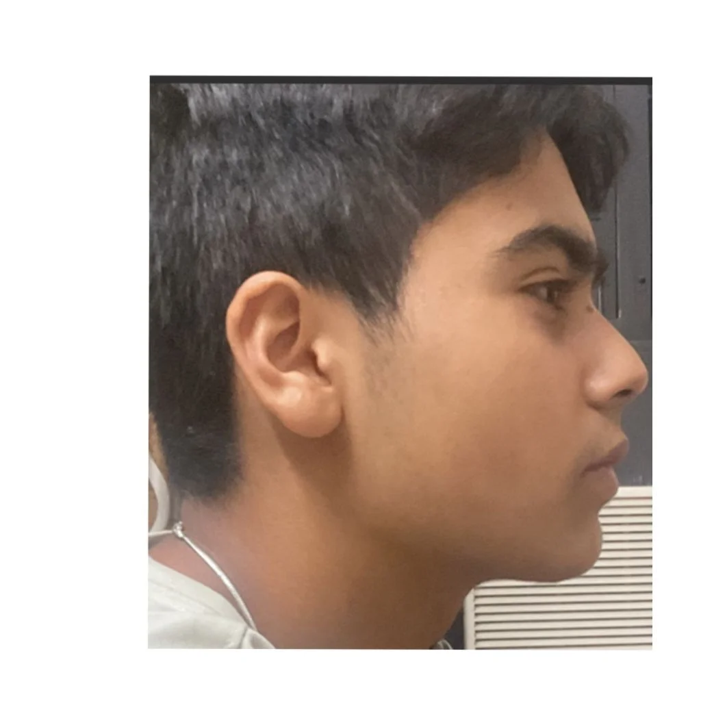 Side Profile